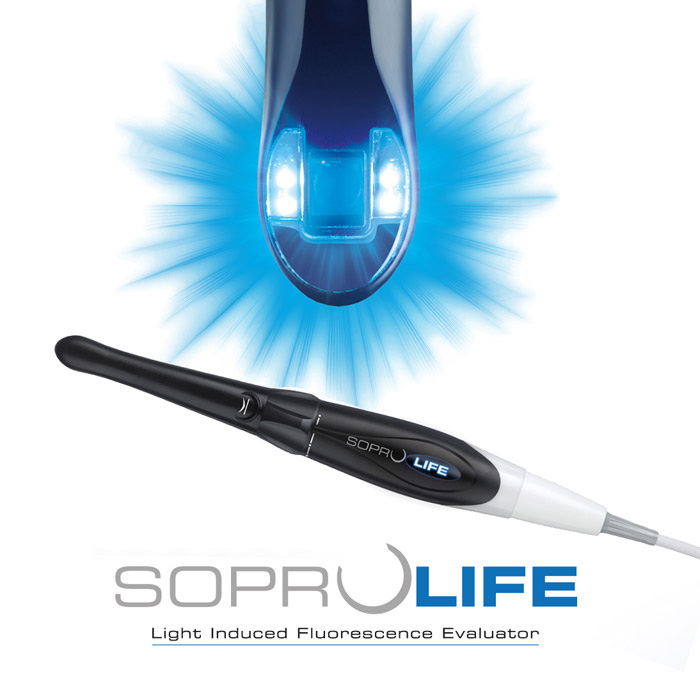 SoproLIFE® Intra-Oral Camera thumb