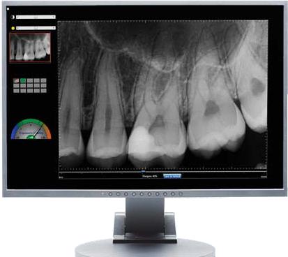 Digital X-rays image